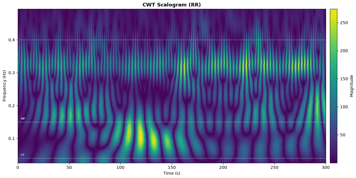 CWT scalogram of RR intervals from MIT-BIH 101