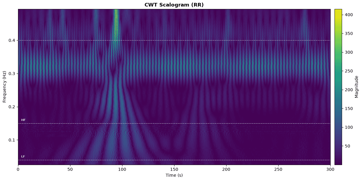 CWT scalogram of RR intervals from MIT-BIH 102