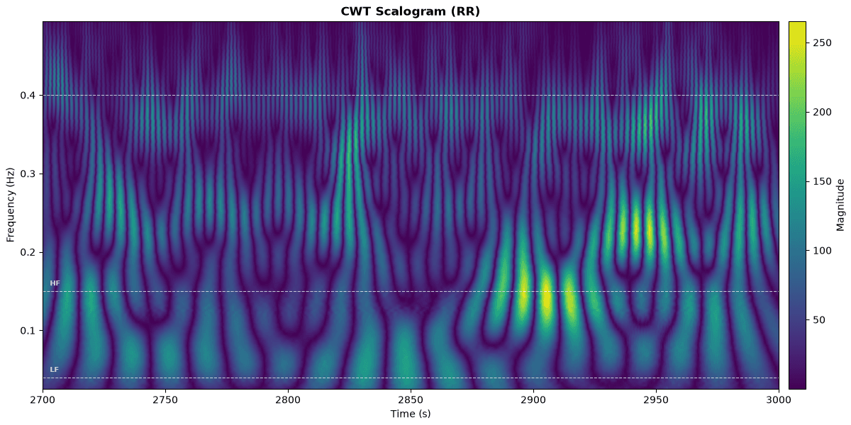 CWT scalogram of RR intervals from MIT-BIH 16272