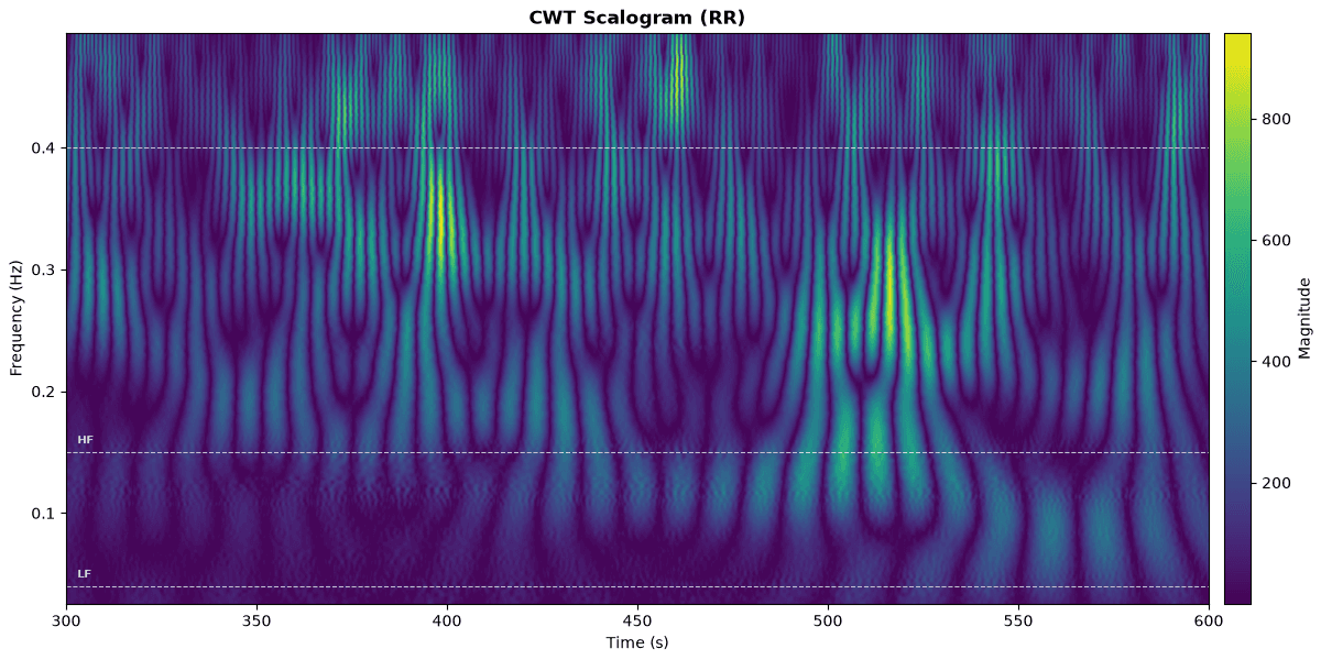 CWT scalogram of RR intervals from SDDB 35